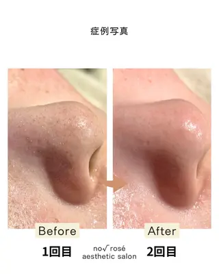 ノールート ロゼのエステ・リラクイメージ