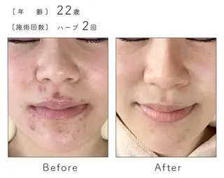 ハーブピーリング専門 BIOEL横浜のエステ・リラクイメージ