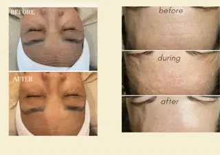 艶肌ワックス ALLY.のエステ・リラクイメージ