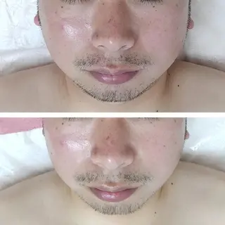 ユニセックスエステサロンUniclear所属・男女エステ ユニクリアのエステ・リラクイメージ