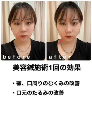 鍼灸整骨院Refine所属・鍼灸 Refineのその他イメージ