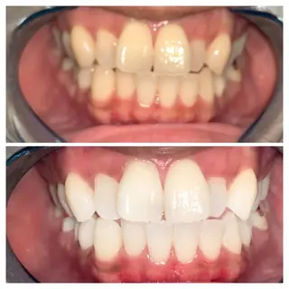 ネイル ヘアアレンジ ロング カラー メンズ マツエク・マツパ アイブロウ キッズ パーマ ライトビューティー 銀座店のエステ・リラクイメージ