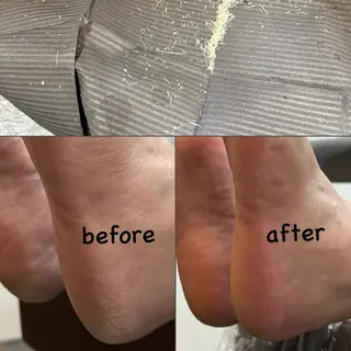 Acoonail 宮田のその他イメージ