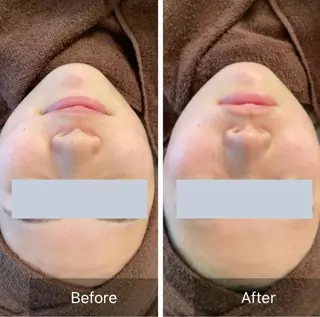 Lumiere despoir所属・Lumiere despoirのエステ・リラクイメージ