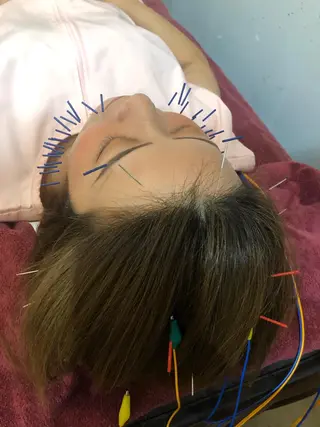 美容鍼灸女性専用 りんご鍼灸治療院のその他イメージ