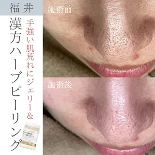 毛穴ケア専門サロン Yourmeユアミーのエステ・リラクイメージ