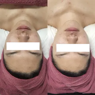 小顔・ツルツル素肌 ハリステリアのエステ・リラクイメージ