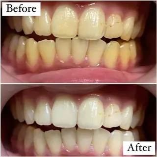 LBSホワイトニング 🌐渋谷店 小河原のエステ・リラクイメージ