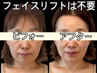 小顔専門看護師クリニカルサロンCOCO所属・ローマピンクと小顔 クリニカルサロンココのエステ・リラクイメージ