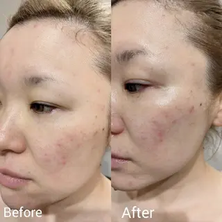 フェイシャルエステ ラトゥール伊深のエステ・リラクイメージ