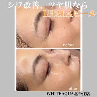 WHITE AQUA 北千住店のエステ・リラクイメージ