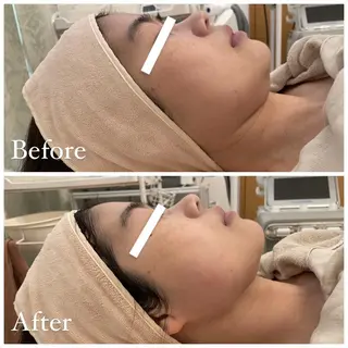 ✨美肌水光✨ アトリエリュバンのエステ・リラクイメージ