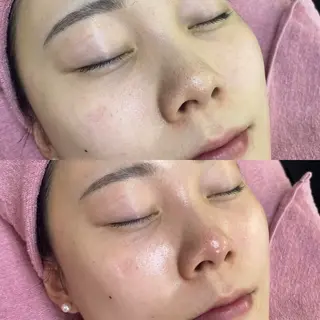 siro スタッフのエステ・リラクイメージ