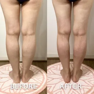 hitohana所属・毛穴/いちご鼻/小顔 /hitohanaのエステ・リラクイメージ