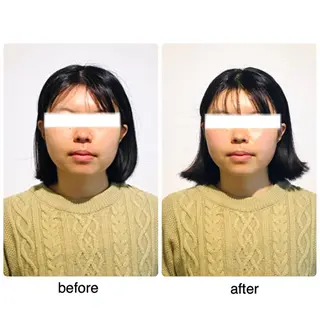 ミディアム ヘアアレンジ ネイル マツエク・マツパ 小顔矯正専門サロンジュマリ所属・町田 淳子のエステ・リラクイメージ