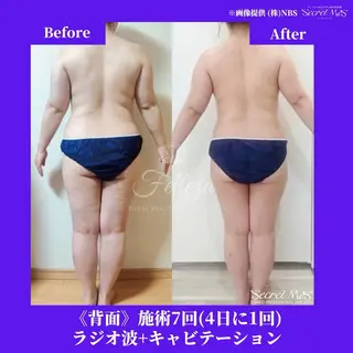 メンズ 有人型セルフサロン 脱毛/痩身/美顔のその他イメージ