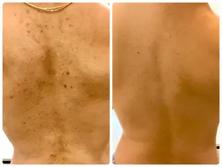 フェイシャル専門 肌質改善/プランスのエステ・リラクイメージ