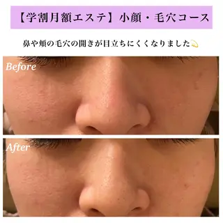 Bellesthe (ベルエステ)のエステ・リラクイメージ