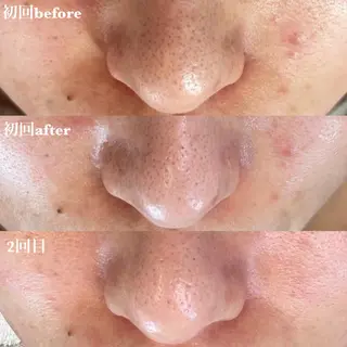 Luana アイラッシュ& フェイシャル所属・Luana eyelashのマツエク・マツパデザイン