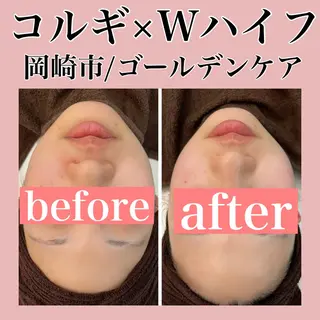 ■超絶小顔＆肌管理室■所属・🦋整形級の究極美顔 本格韓国式小顔🦋のエステ・リラクイメージ