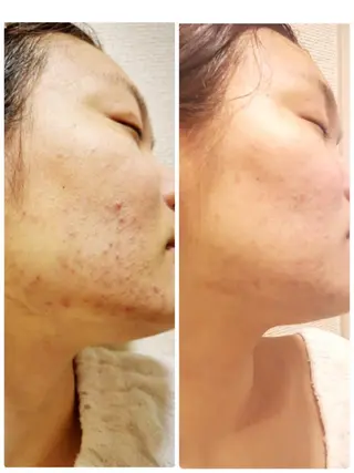 プログレス所属・秋山 香織のエステ・リラクイメージ