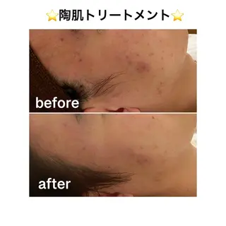 アロマ,陶肌 SalonYokoのエステ・リラクイメージ
