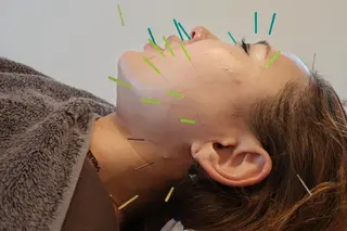 即効⚡小顔美容鍼🪡 むくみたるみ脂肪解消のエステ・リラクイメージ