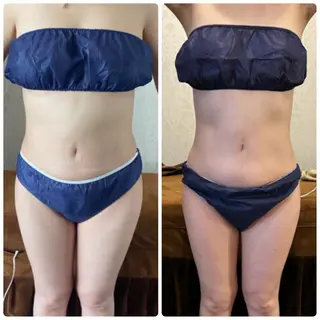 FLEUR大阪・整体 ・ハイフ・痩身・小顔のエステ・リラクイメージ