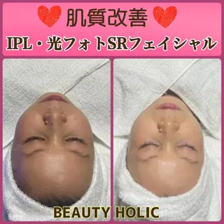 ニキビ・ 肌荒れ専門店のエステ・リラクイメージ