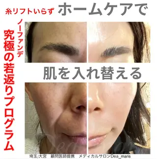 private salon Dea_maris シュガーリング&パーソナルボディケア所属・シミ改善・韓国肌管理 ボディメイク痩身のその他イメージ