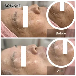 美sorciere所属・現役看護師サロン めぐみのエステ・リラクイメージ