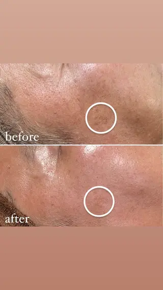 brilliance所属・老化肌トラブル肌専門 Brillianceのエステ・リラクイメージ