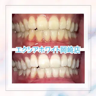 セルフホワイトニング エクシア岡崎店所属・ホワイトニング/脱毛 専門店エクシア岡崎店のその他イメージ