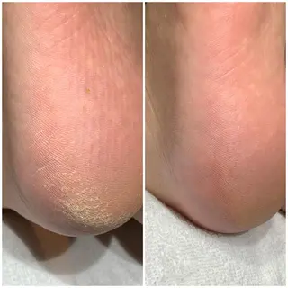 ネイル ROUN'　南 鈴沙のネイルデザイン