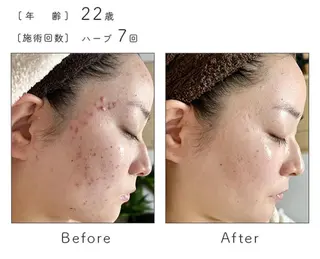 ハーブピーリング専門 BIOPLUS+川崎のエステ・リラクイメージ