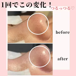 ピーリング専門店 Belluteのエステ・リラクイメージ