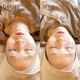 MiEL total beauty salon所属・Rie ×MiELのエステ・リラクイメージ