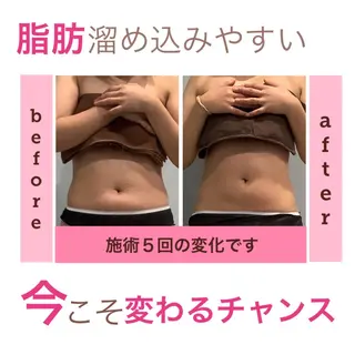 エステサロン JURISのエステ・リラクイメージ