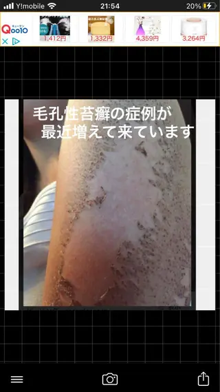 ロング カラー パーマ ヘアアレンジ メンズ キッズ ネイル マツエク・マツパ アイブロウ ハーブピーリング専門 🌿モッカのエステ・リラクイメージ