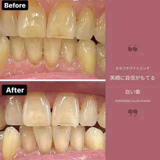 ホワイトニングサロン プレジールのエステ・リラクイメージ