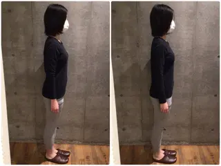 目黒/小顔/骨盤/ 美容鍼/美顔鍼/小林のエステ・リラクイメージ