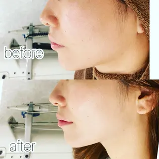 laluna saki...のその他イメージ