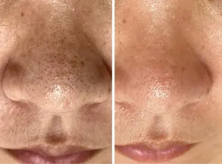 NOAH 小顔毛穴　川越店所属・NOAH ORIEのエステ・リラクイメージ