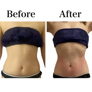 Beauty SalonEclatのエステ・リラクイメージ