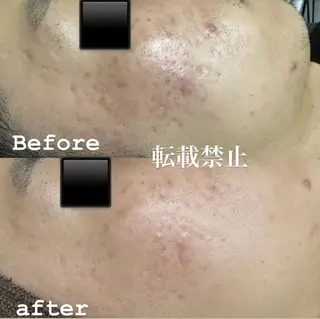 メンズ sincerity salonのエステ・リラクイメージ