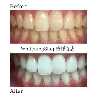 ホワイトニング専門店 御殿山/吉祥寺店のその他イメージ