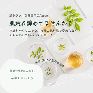 ニキビ特化型サロン 🌈20代ニキビ特化のエステ・リラクイメージ