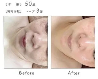 ハーブピーリング専門 BIOPLUS+川崎のエステ・リラクイメージ