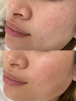 Salon de Galcon 2階(サロンド・ギャルソン)所属・KU TA  \(◡̈)/の眉毛・アイブロウイメージ