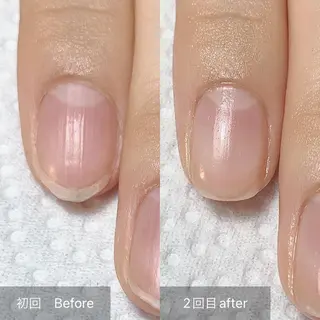 ネイル 木村 千晴のネイルデザイン